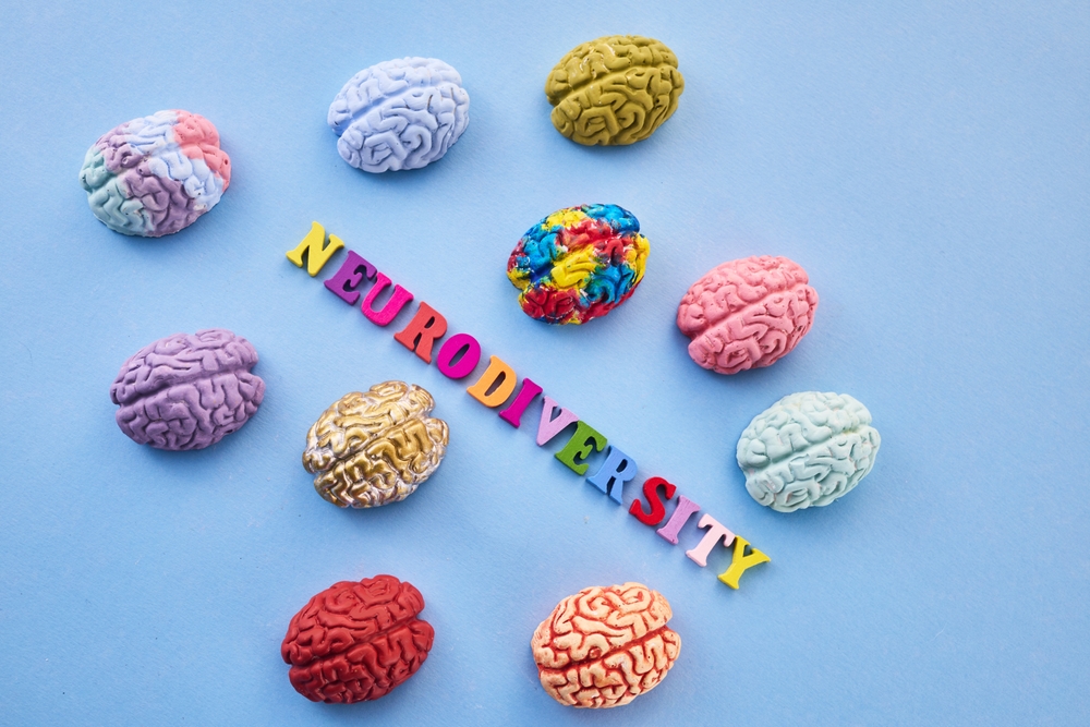 How_to_manage_neurodiverse_employees
